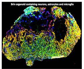 "Brain organoid containing neurons, astrocytes and microglia"