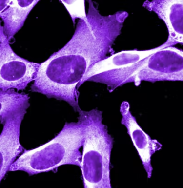 How cancer cells can become immortal 