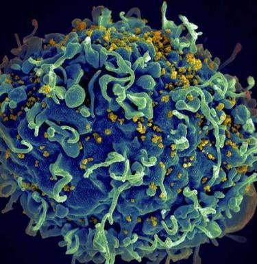 Pitt study points to new opportunities for HIV treatment